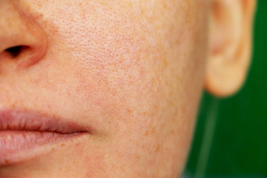 Diy Natural Face Primer For Oily Skin 365 Gorgeous