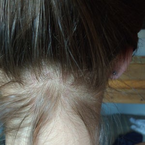 how to grow nape hair