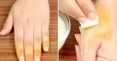 How To Remove Turmeric Stains From Skin