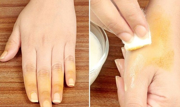 How To Remove Turmeric Stains From Skin